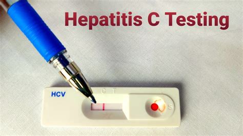 what does 0.1 mean on a hep c test|What to expect when getting tested for Hepatitis C .